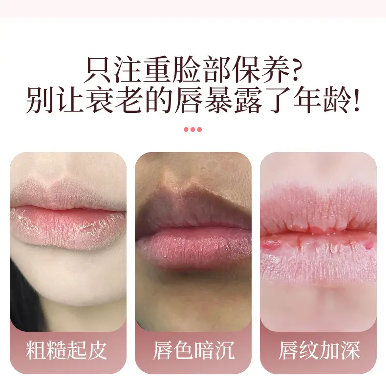 Cross-Border Lip Beauty Device Led Red Light Heating Portable Lip Plumping Device Collagen Hydrating Skin Rejuvenation Plump Lips Beauty Lip Plumping Device — feature 3