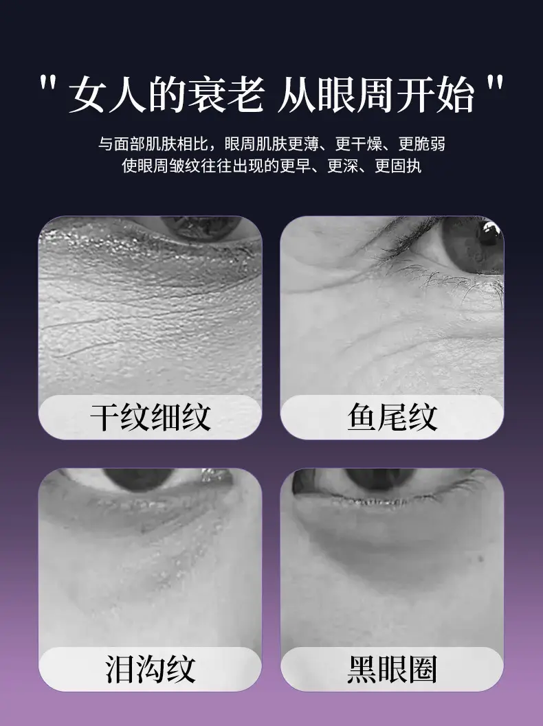 Manufacturer's Eye Massager with Heating Function, Beauty Device, Ems Eye Care Device, Hot Compress for Dark Circles, Electric Eye Beauty Device — feature 3