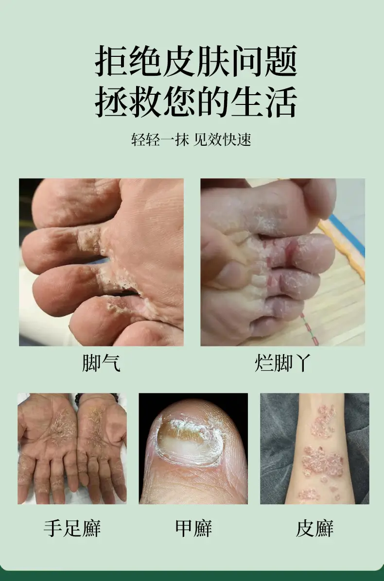 Jiusengtang Osmanthus Snake Oil Ointment 50g Skin External Care Ointment Oem Private Label Plant Herbal Antibacterial Cream — feature 3