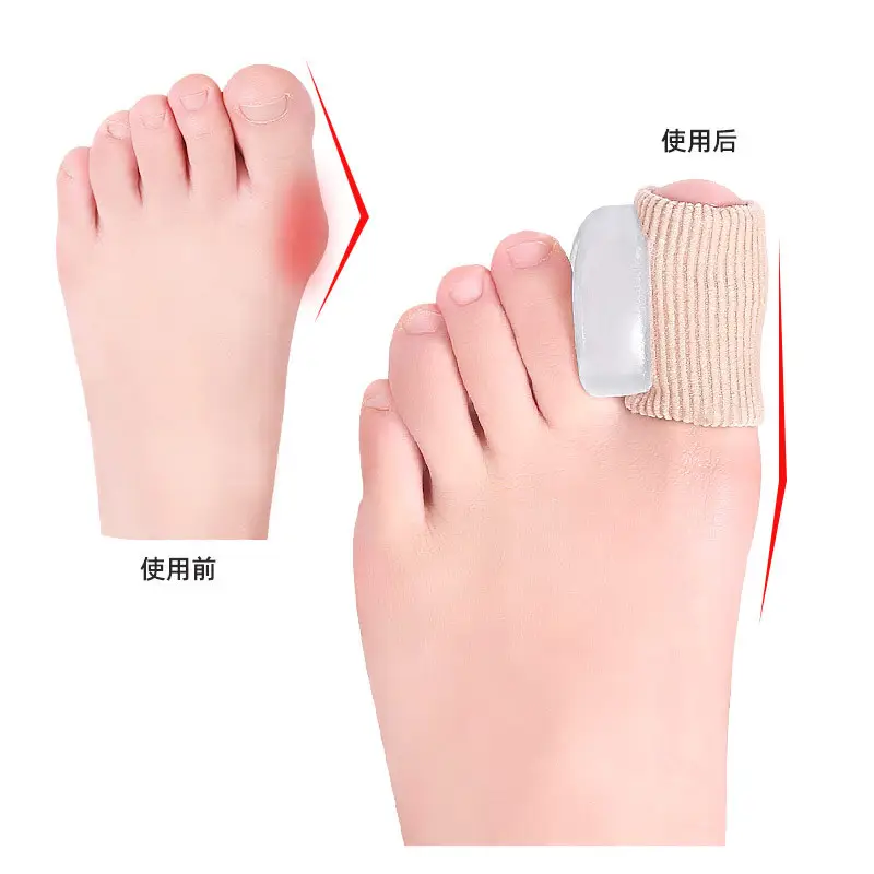 Hallux valgus separator fiber sleeve gel separation big toe bone big toe protruding big toe sleeve - Image 3
