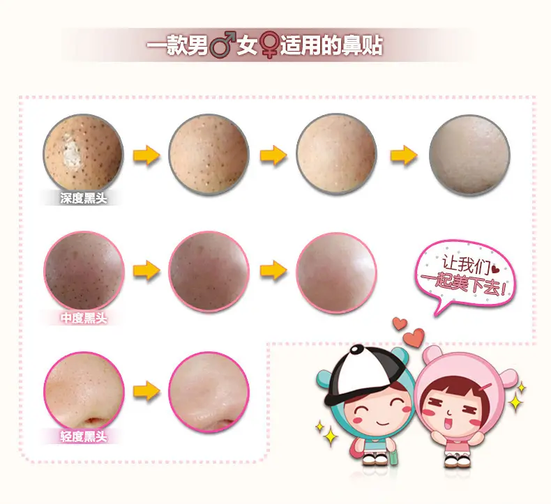 Boquanya Nose Blackhead Remover Trilogy 3 Pcs — feature 21
