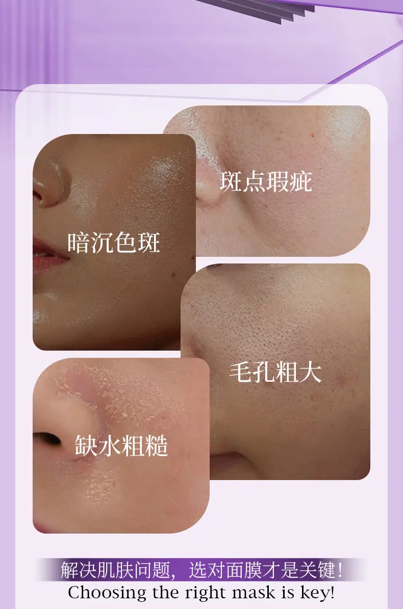 Yizhichun Silk Protein Mask Moisturizing Spring Summer Hydrating Skin Care — feature 18