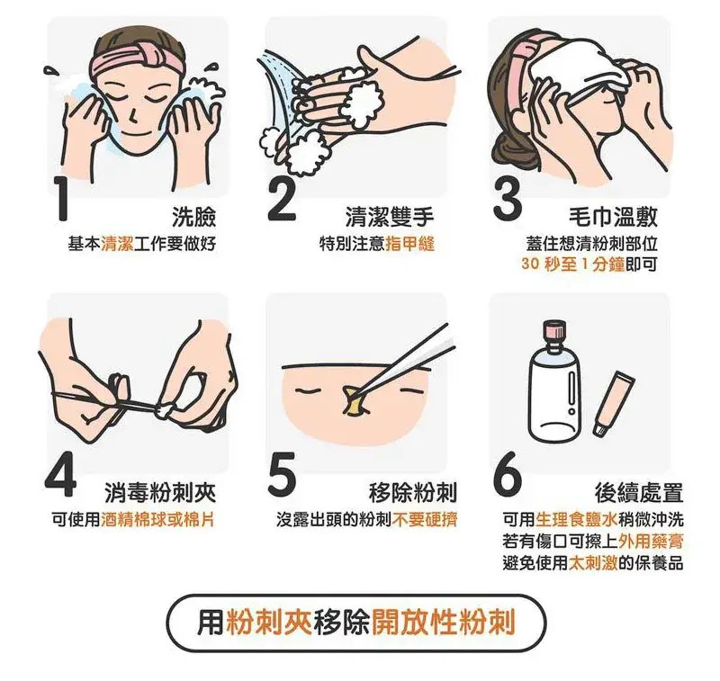 粉刺夹使用说明