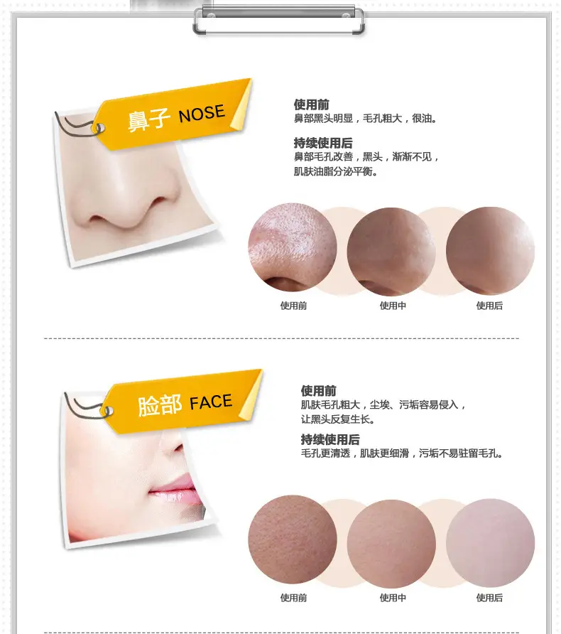 Boquanya Blackhead Remover Mask Cream for Pore Shrinkage — feature 11