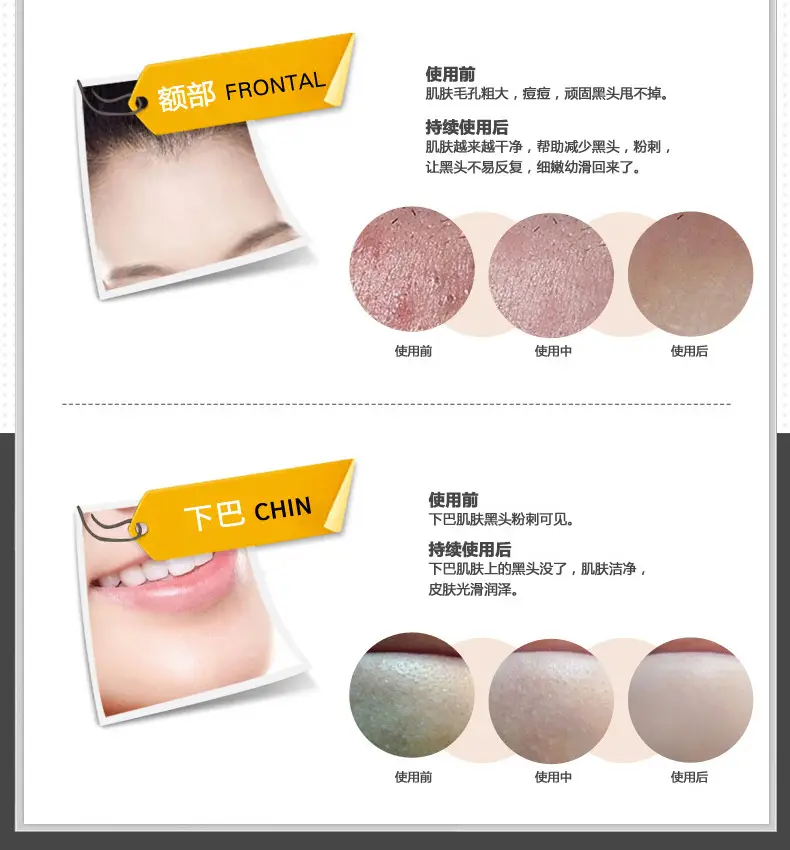 Boquanya Blackhead Remover Mask Cream for Pore Shrinkage — feature 12