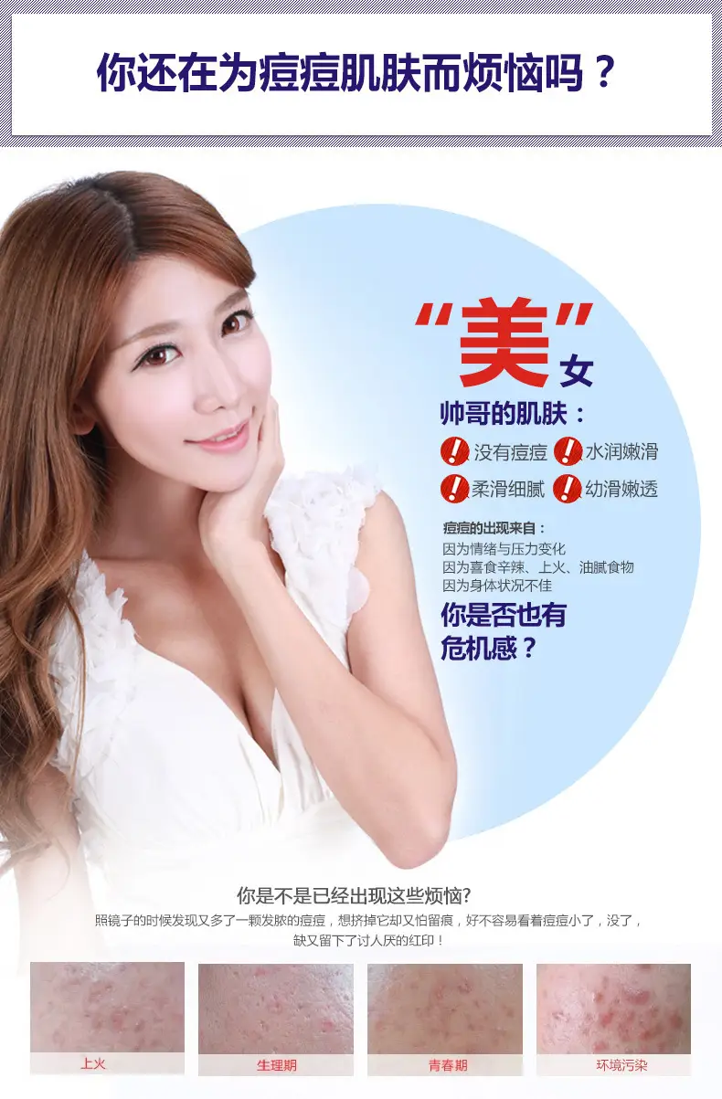 Fanzhen Boquan Whitening Cream 20g Anti-Acne Hydrating Winter Use — feature 41