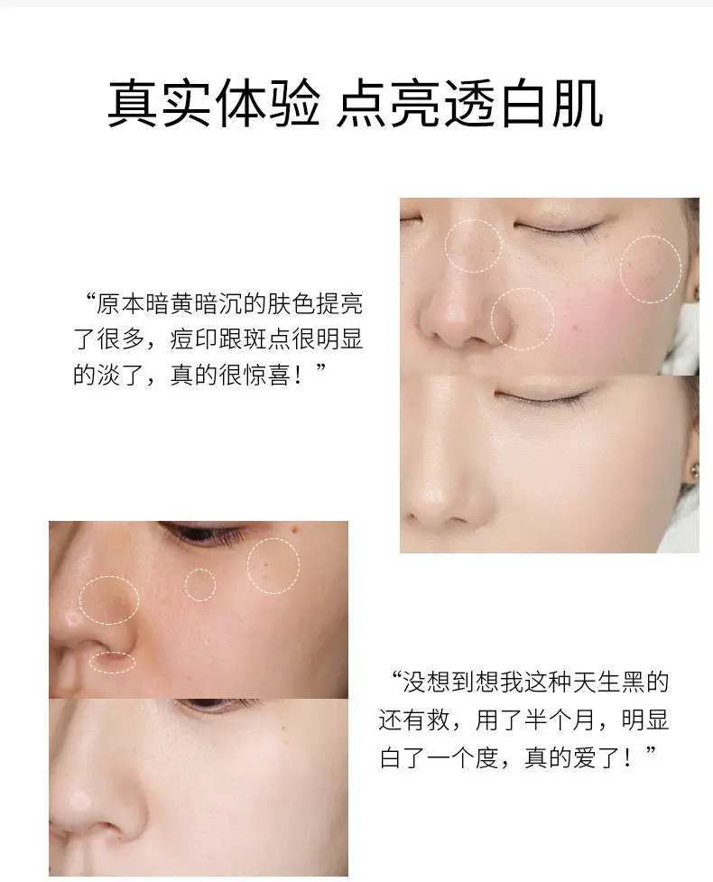 Fanzhen Boquan Whitening Cream 20g Anti-Acne Hydrating Winter Use — feature 44