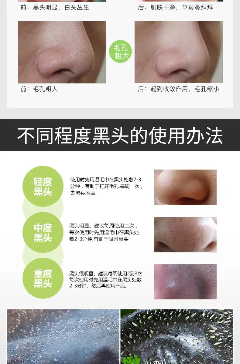 Boquan Blackhead Removal Nasal Mask Paste — feature 21
