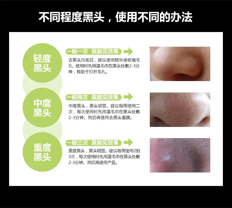 Boquanya Blackhead Remover Mask Cream Peel-Off Type — feature 22