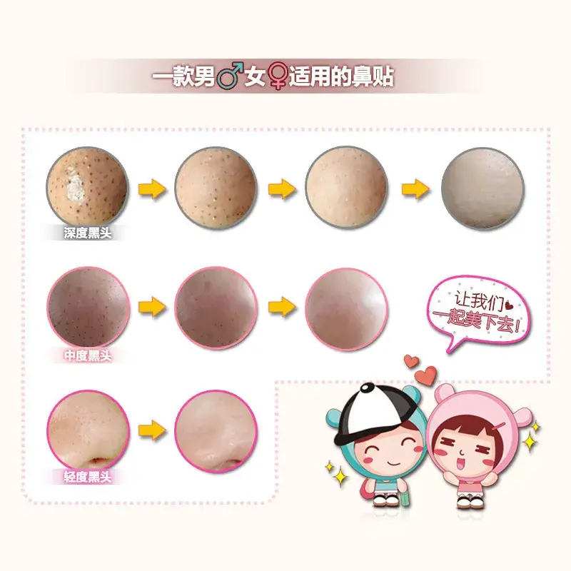Nose Sticker Absorbing Whitehead Acne Shrinking Pores - Image 3