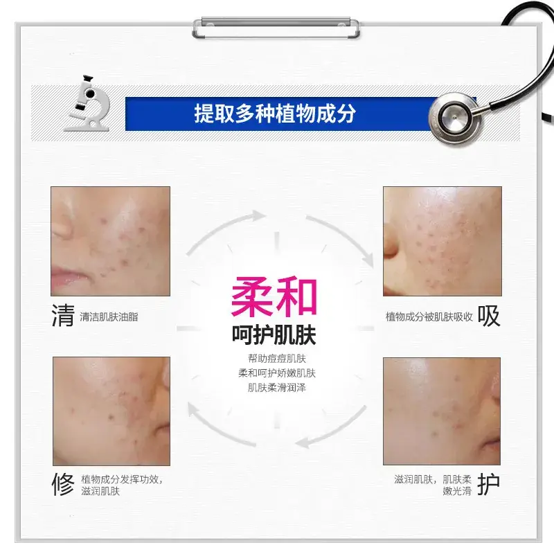 Anti-Acne Oil Control Cream for All Skin Types - Image 5