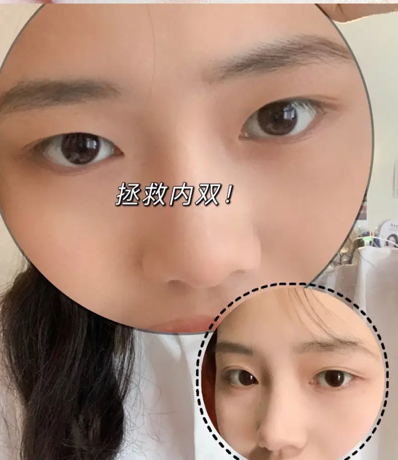 XIXI Heart-Shaped Double Eyelid Stickers for Natural Beauty — feature 11