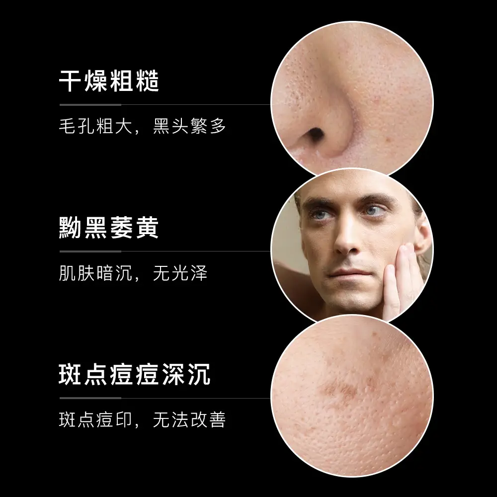 Men Facial Care Set Winter Moisturizing Blue - Image 5