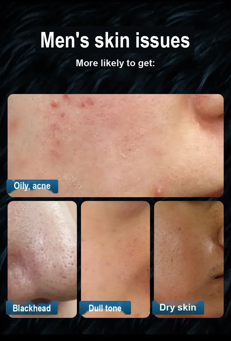 Graphic showing men's skin concerns with several skin close-ups.