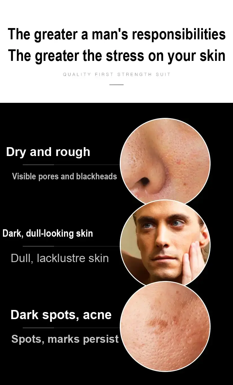 Skincare concern graphic with skin close-ups and a male model.