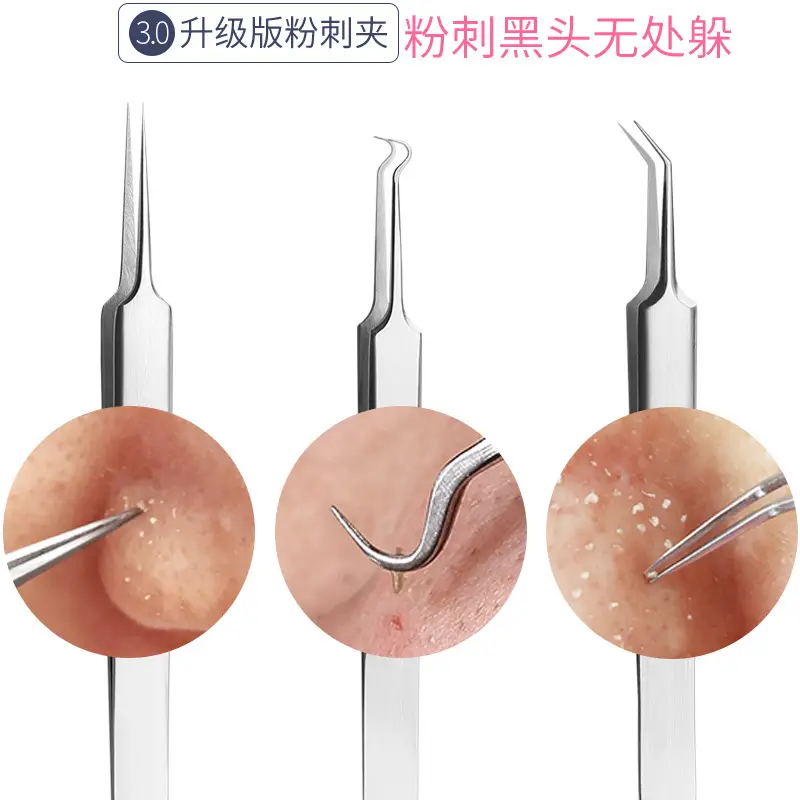 Acne Removal Tools Set for Skin Care