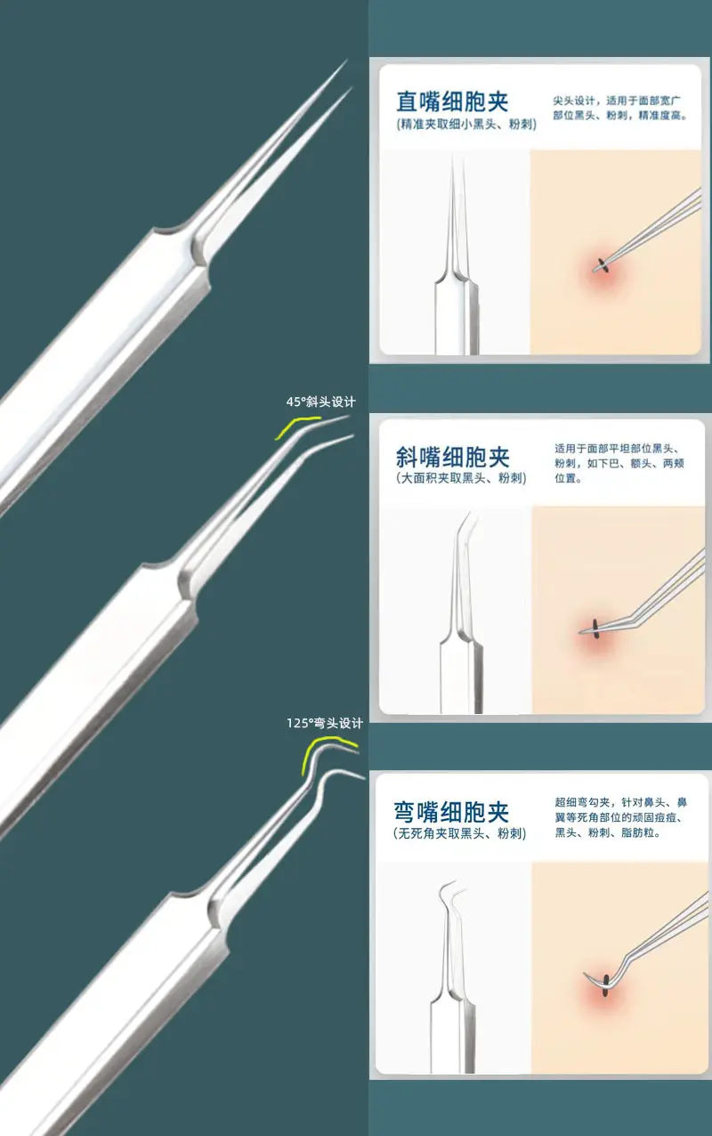 Stainless Steel Blackhead & Acne Clip Tools — feature 7