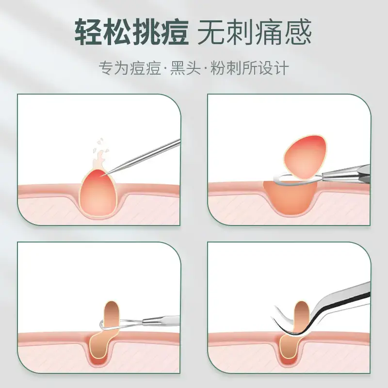 Acne Removal Needle & Tweezers Set for Pimple Removal