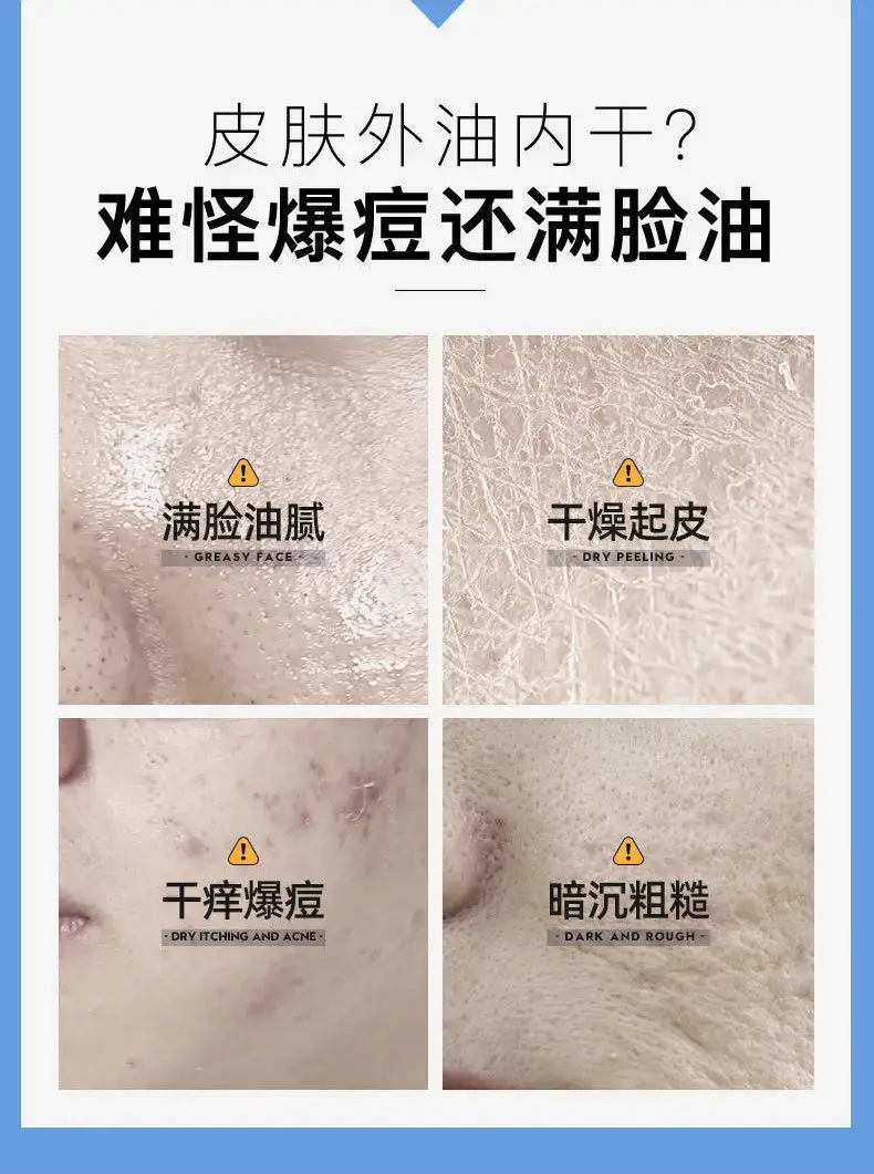 Qianyu Men Face Cream Moisturize Dry Skin Autumn Winter — feature 3