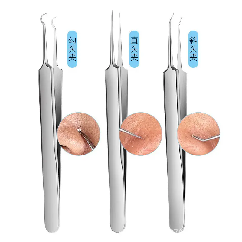 Stainless Steel Cell Clip Tweezers Set for Acne Removal - Image 20