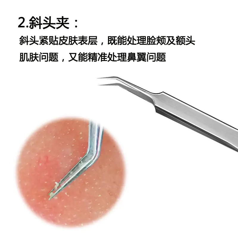 Stainless Steel Cell Clip Tweezers Set for Acne Removal — feature 9