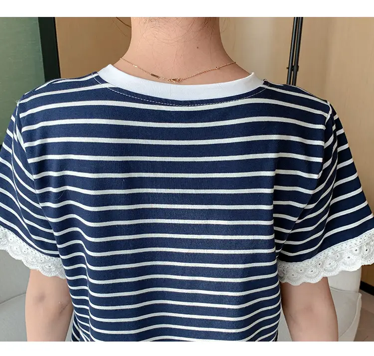Striped Lactation Dress for Women Summer — feature 23