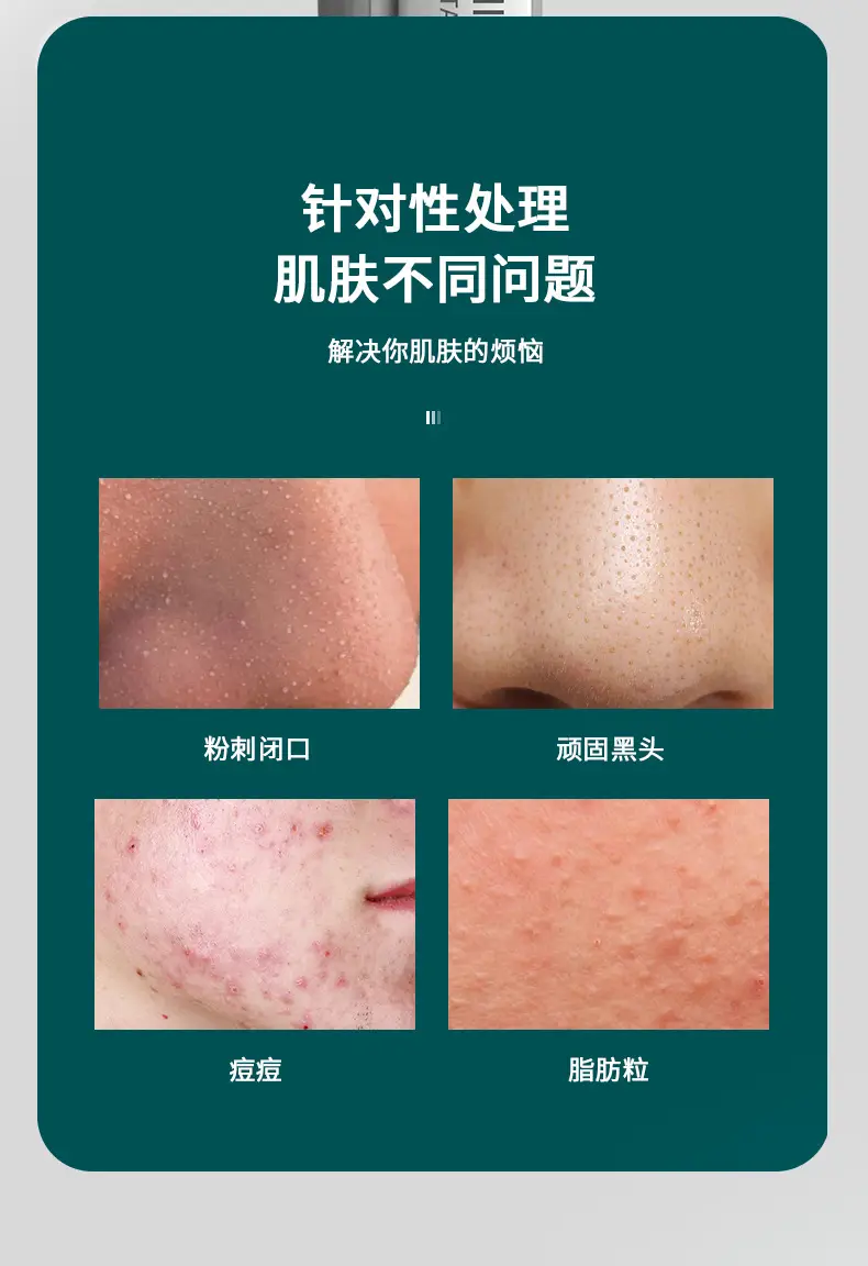 8号款粉刺夹_04