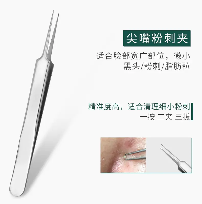 Stainless Steel Acne Needle 5-Piece Set Blackhead Clip — feature 10