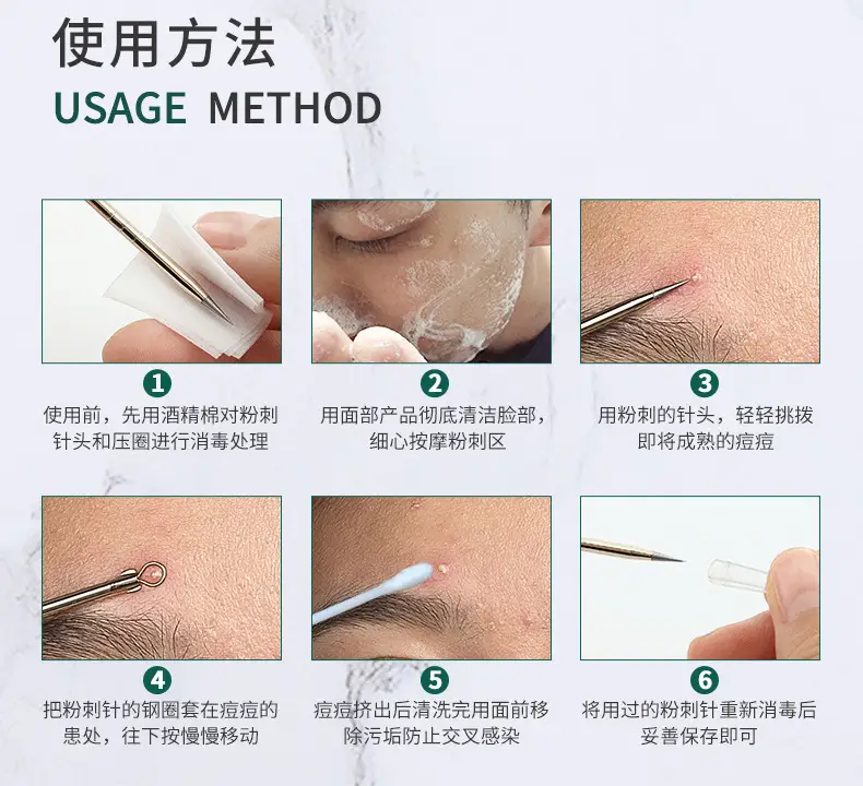 Stainless Steel Acne Needle Set 4-Piece Rose Gold — feature 10
