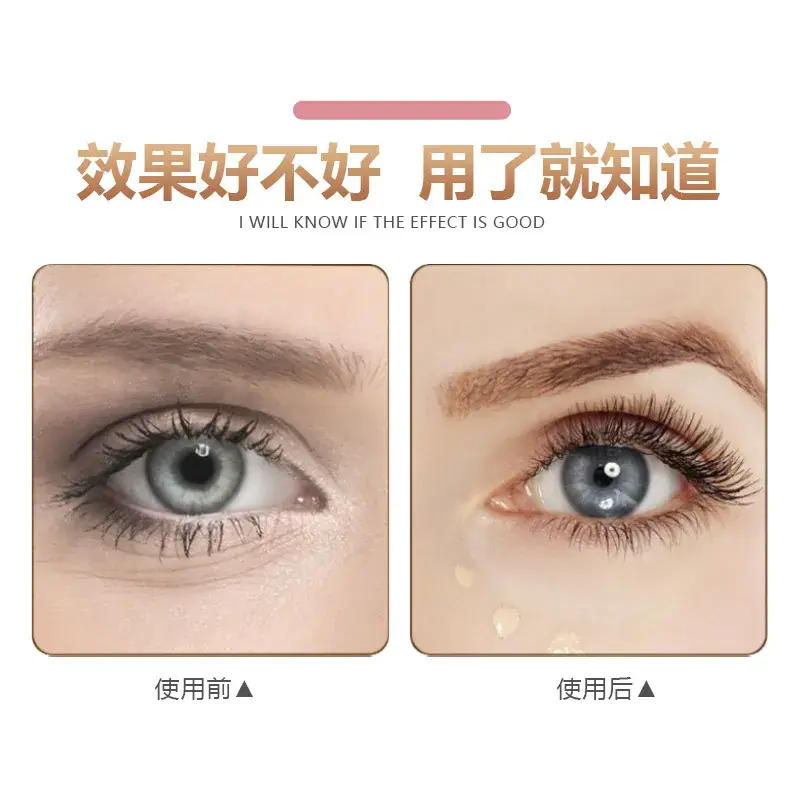 5D Eyelash Curler for Women Rechargeable Multifunctional - Image 4