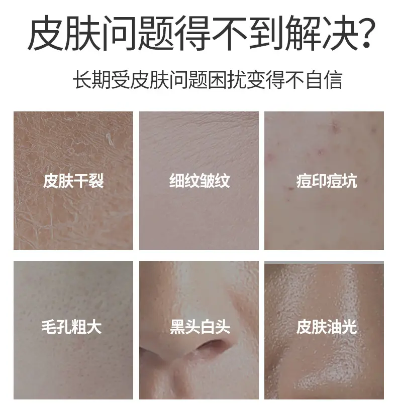 Wholesale Mummy Mask Litches Tight V Face 3D Shaping Plaster Bandage Bracket Face Mask Paper — feature 3