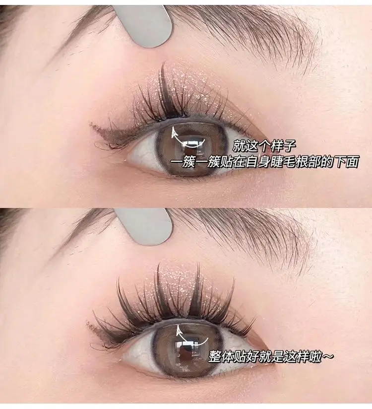 Eagle Beak Clip Cat Ciliary Eye Mirror — feature 10