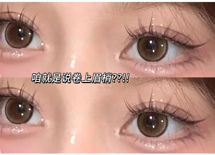 Eagle Beak Clip Cat Ciliary Eye Mirror — feature 4