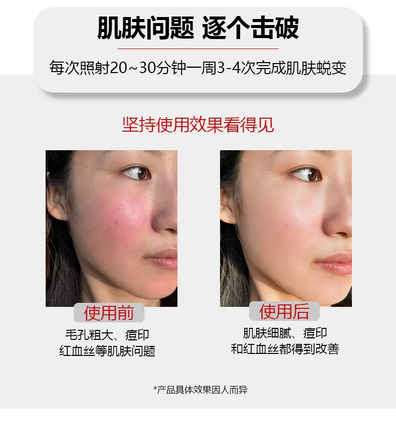 Cross-Border Foreign Trade Led Red Light Beauty Mask, Home-Use Photon Rejuvenation Device, Silicone Skin Rejuvenation Electronic Beauty Device — feature 14