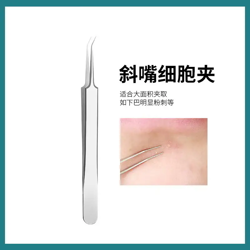 Acne Clip Blackhead Removal Tools for Closed Mouth Use - Image 2