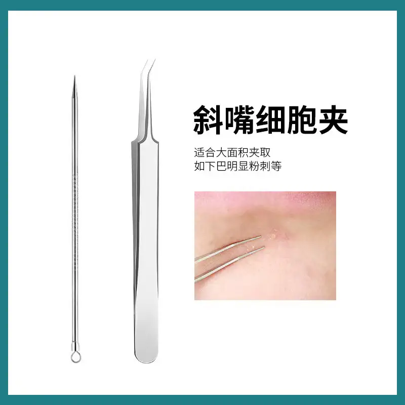 Acne Clip Blackhead Removal Tools for Closed Mouth Use - Image 5