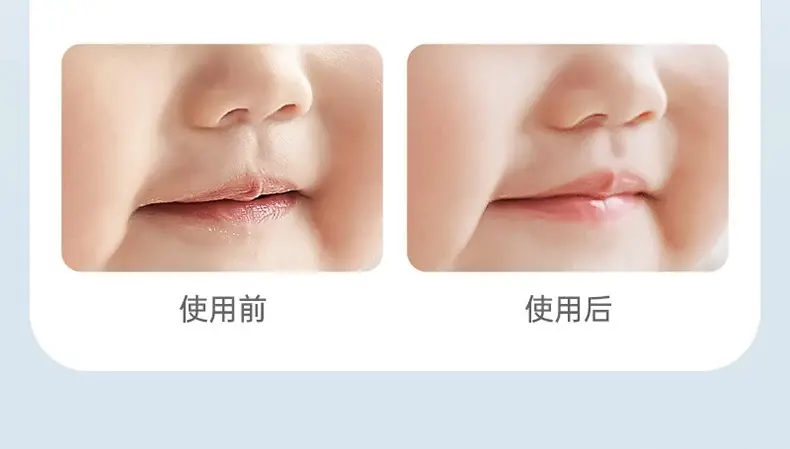 Zichu Children's Moisturizing Baby Lip Balm Anti-Drying Autumn Winter — feature 11