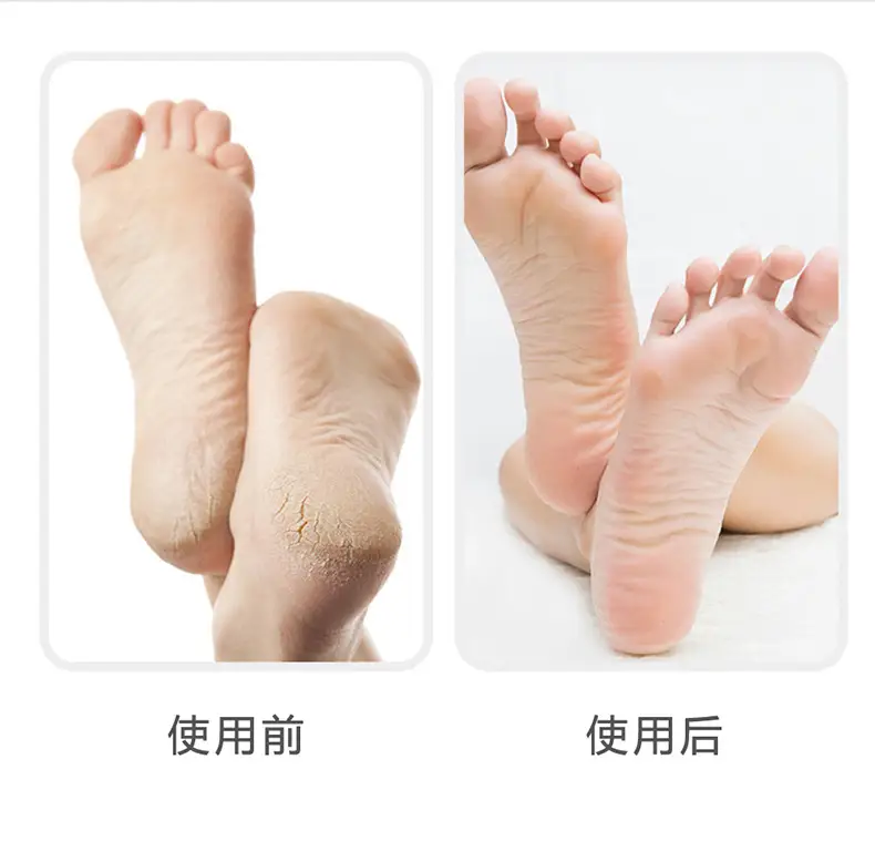 Wooden Foot Exfoliator for Smooth Skin-Free Feet — feature 10