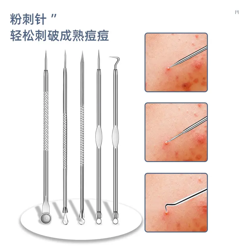 Stainless Steel Acne Clip Needle Set Blackhead Removal Tools - Image 14