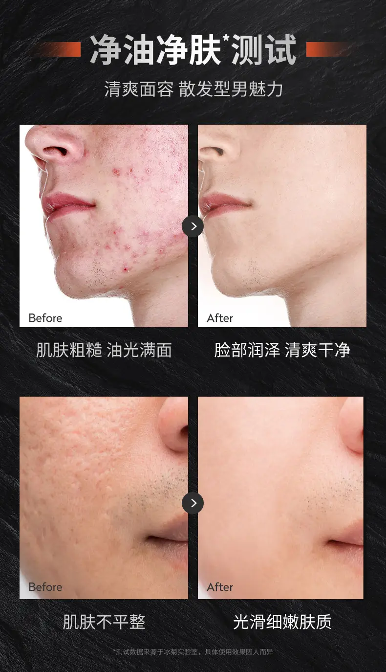 Men's Volcanic Mud Facial Cleanser Set — feature 11