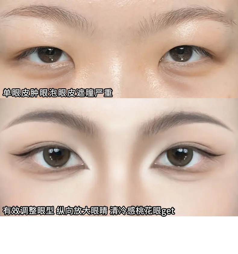 Double Eyelid Stickers for Natural Look — feature 4