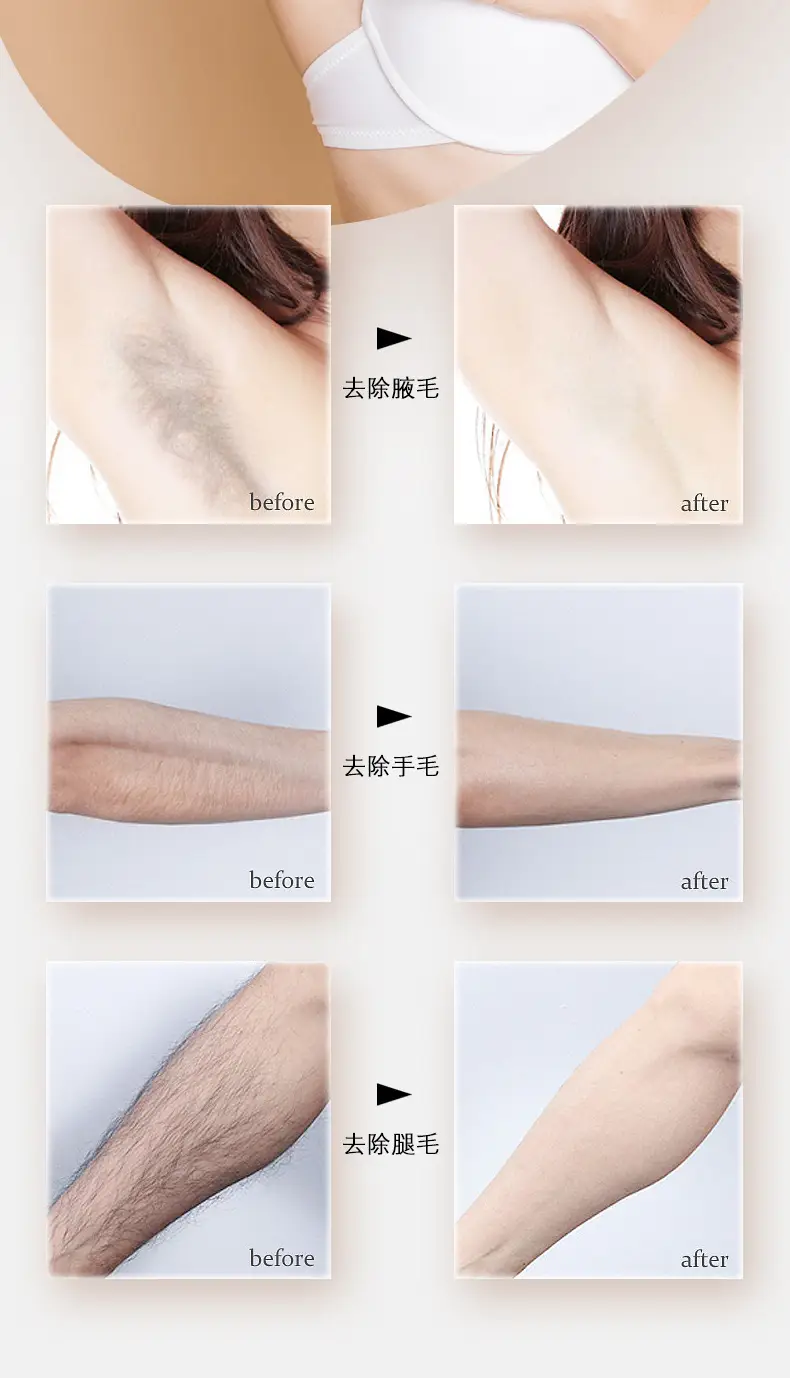 Four-in-One Women's Electric Underarm Razor Trimmer Scraper — feature 5