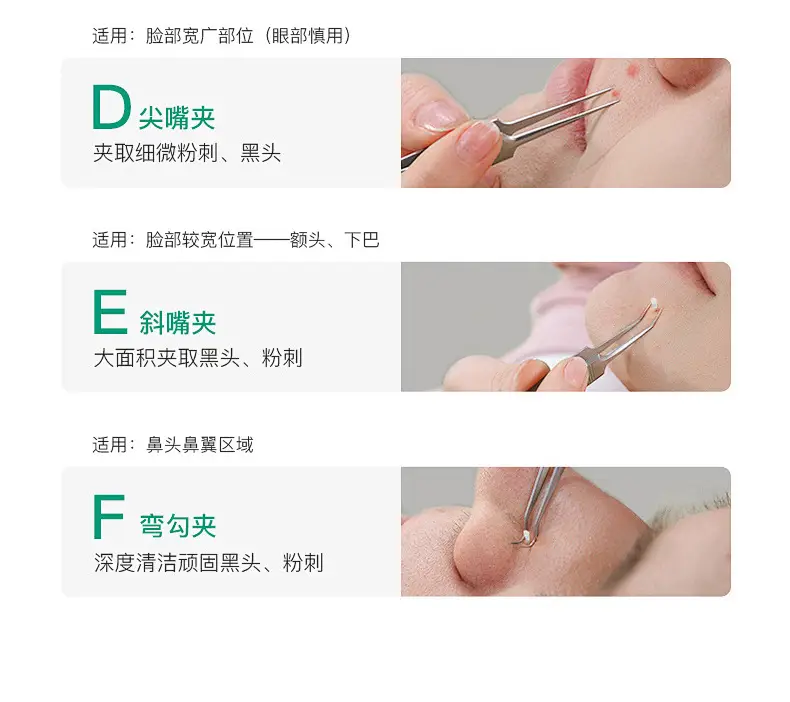 Ultra-fine Acne Needle Clip Blackhead Tweezers — feature 5