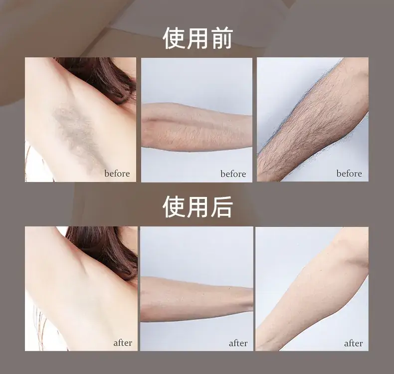 Women's Full Body Epilator for Armpit & Pubic Hair Removal — feature 4