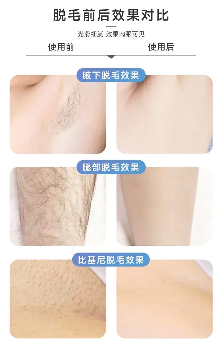Mini Electric Hair Removal Device for Women & Men — feature 8
