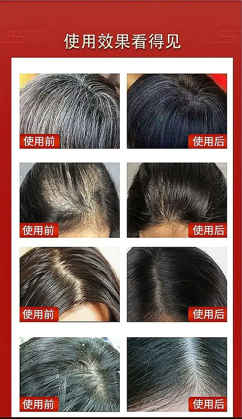 Kang Yuhua Energy Comb for Hair Growth 6th Gen Core Hertz — feature 4