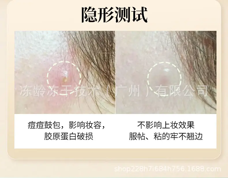 Invisible Acne Patch for All Skin Types — feature 12