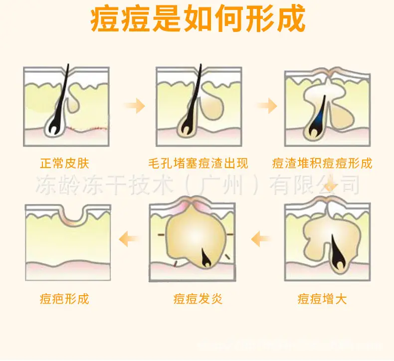 Invisible Acne Patch for All Skin Types — feature 7