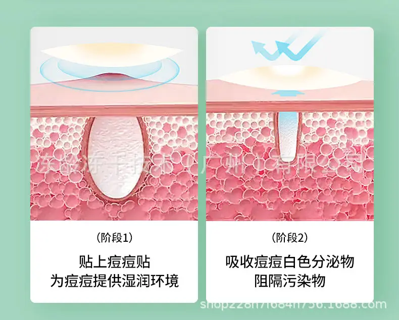 Invisible Acne Patch for All Skin Types — feature 8