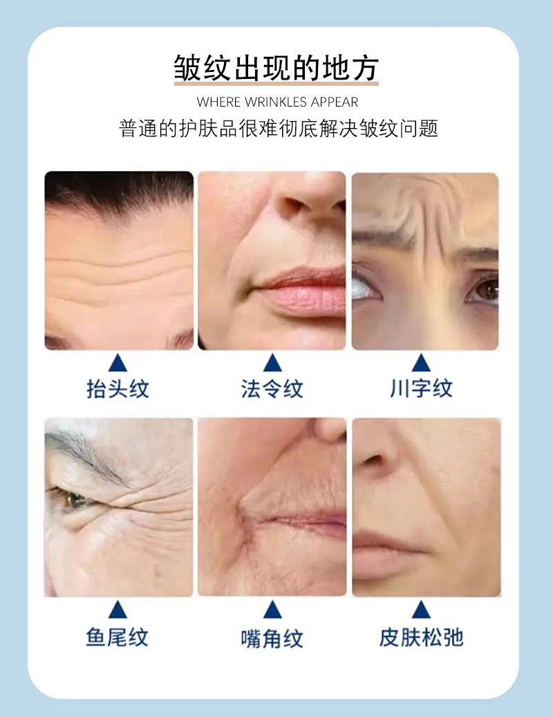 Silicone Anti-Wrinkle Eye Patch 11-Piece Set — feature 8